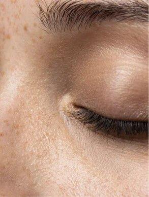 Close-up of skin around the eye showing natural texture, featured for Eclat Soin Two-Phase Makeup Remover